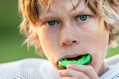 Get Ready for Fall Sports With Custom Mouthguards